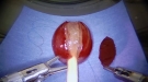 Tiny Surgery Robot Sews Up A Grape